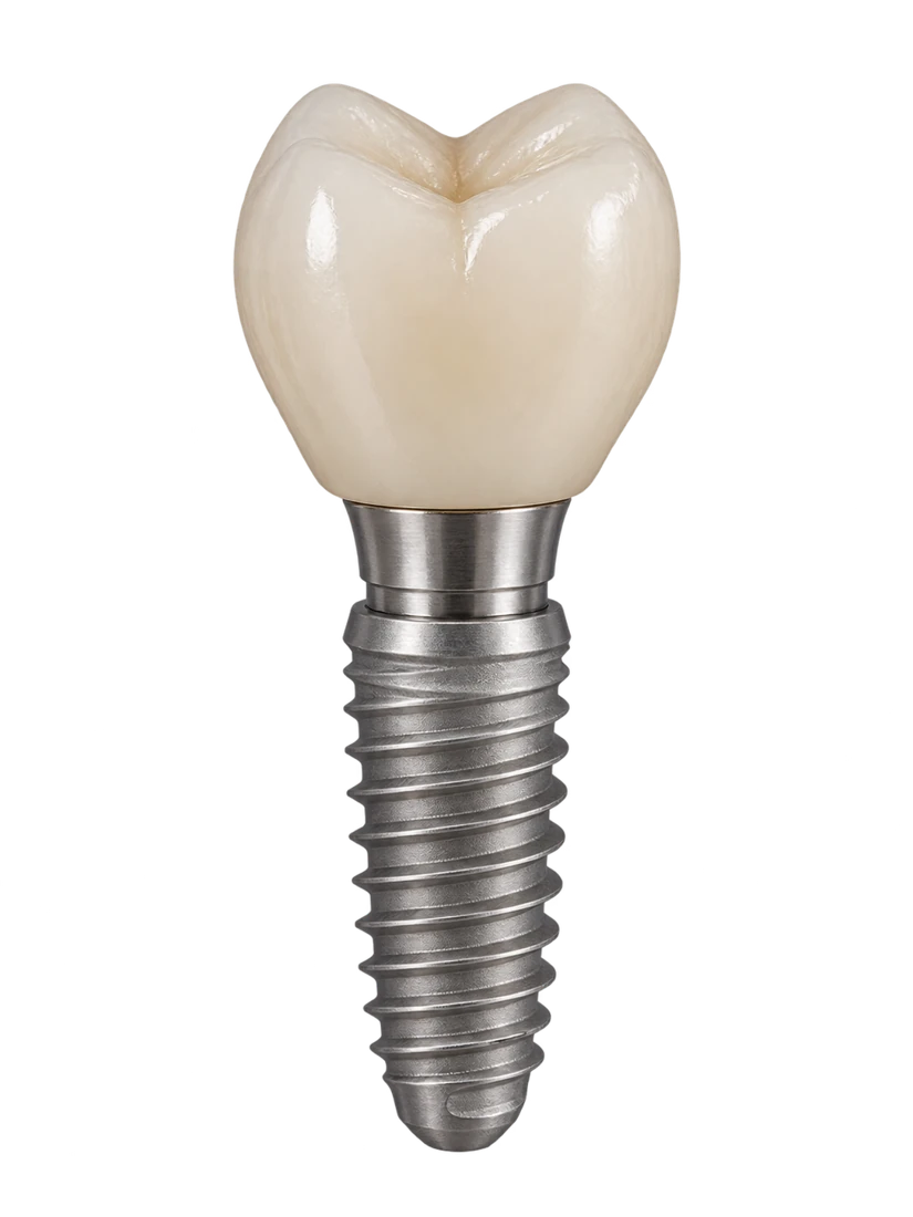 Illustrative dental implants